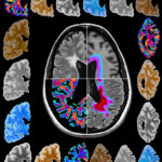 4 – Fondazione Prada – Human Brains Preserving the Brain