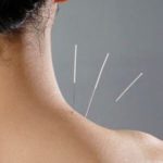 Agopuntura e medicina estetica2