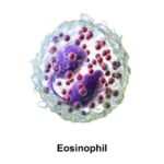Eosinofili