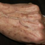 invecchiamento-mani