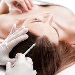 Mesoterapia per Capelli