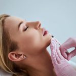 Filler per labbra
